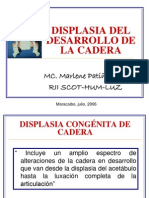 Displasia Del Desarrollo de La Cadera