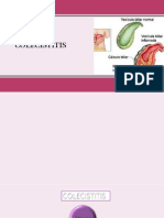 Colecistitis 1