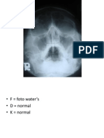 Radiologi Sinus Dan Mastoid