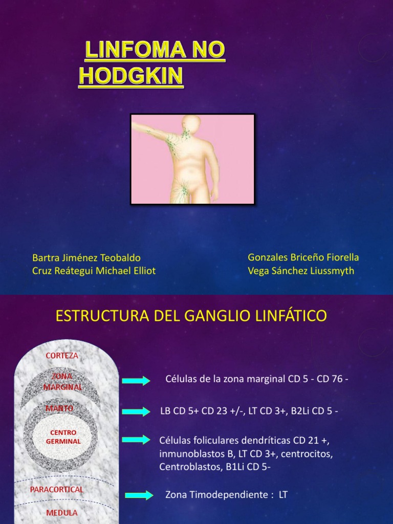 Linfoma No Hodgkin PDF Linfoma Linfocitos