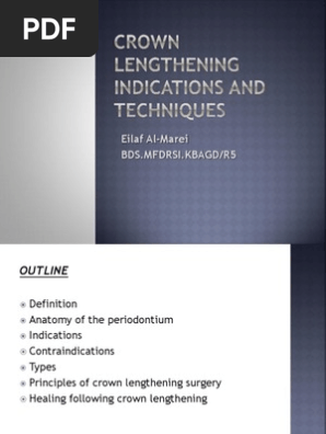 Crown Lengthening