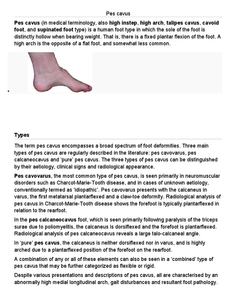 Pes Cavus | PDF | Limbs (Anatomy) | Diseases And Disorders