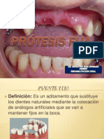 Prótesis Parcial Fija