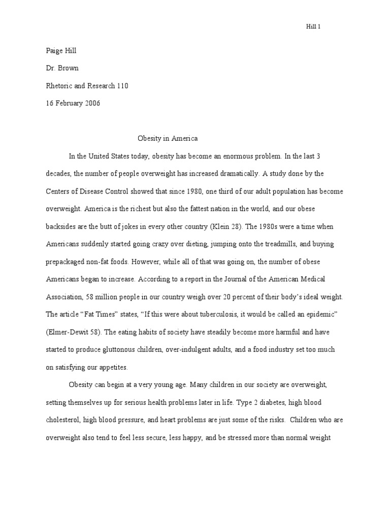 Effects of childhood obesity essay image