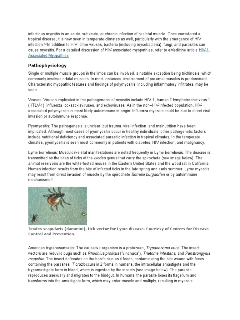 pyomyositis Lyme Disease Infection