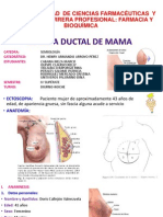 Ectasia Ductal Exponer Yaaaaaaaaa