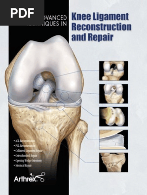 Arthrex Catalogo Knee Pdf Surgical Suture Screw