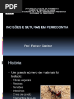 Incisões e Suturas Em Periodontia