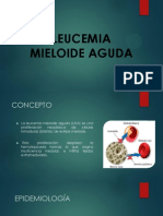 Leucemia Mieloide Aguda