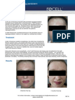 Facial Hypopigmentation.pdf
