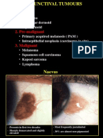 Conjunctival Tumours: 1. Benign