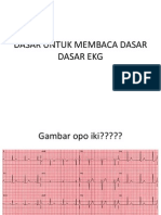 ekg_histo