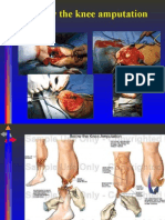 Download Below the Knee Amputation by Darell M Book SN23169608 doc pdf