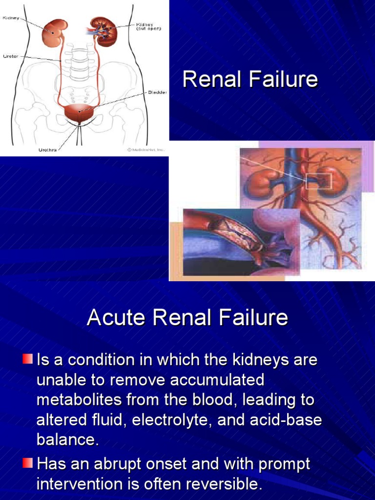 ACUTE RENAL FAILURE ppt Kidney Shock (Circulatory)