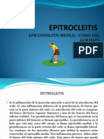 EPITROCLEITIS 2
