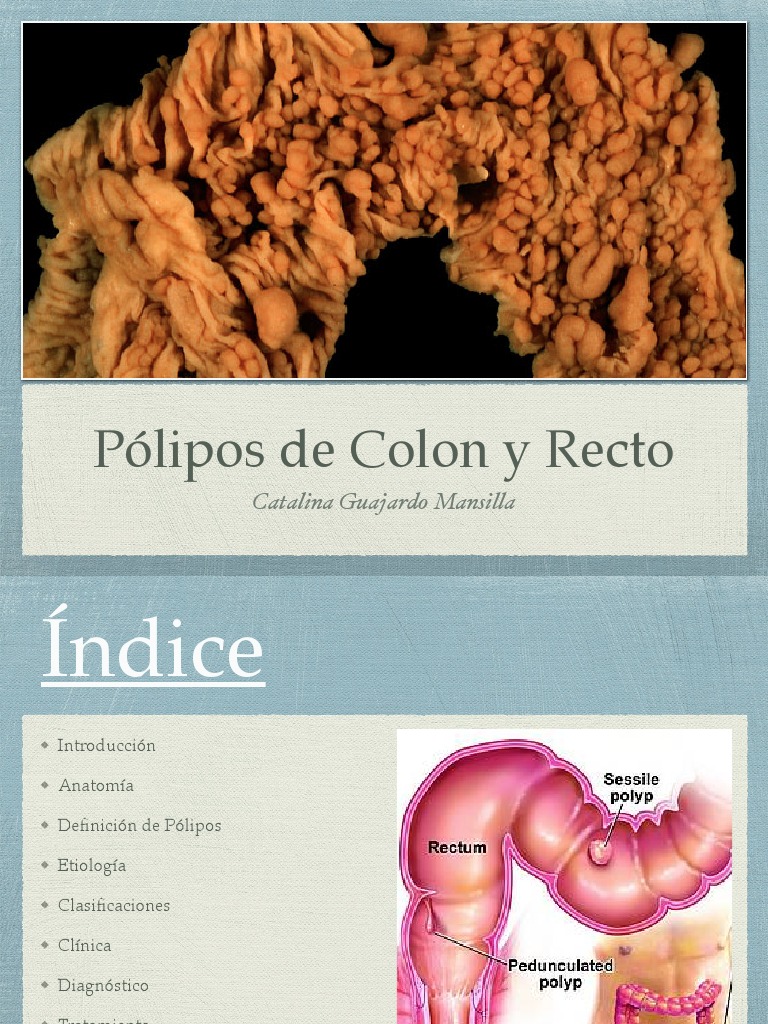 Pólipos en Colon y Recto: Guía Completa | PDF | Cáncer colonrectal | Cáncer