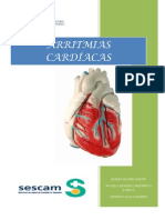 ARRITMIAS CARDIACAS