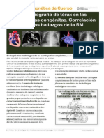 La Radiografia de Torax en Las Cardiopatias Congenitas