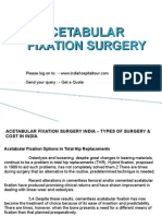 Acetabular Fixation Surgery India - Types of Surgery & Cost in India