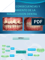 Causas, Consecuencias y Tratamiento de La Maloclusion