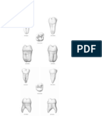 Tercera Molar Superior