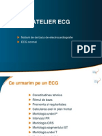 Atelier Ecg: Notiuni de de Baza de Electrocardiografie ECG Normal