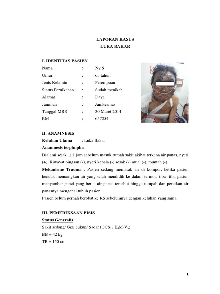 Laporan Kasus Luka Bakar