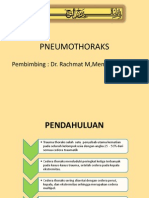 Pneumothorax