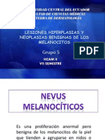 Queratosis Seborreica Nº 2