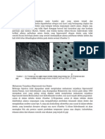 Hipersensitif Dentin