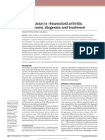 Bone Erosion Rheumatoid Arthritis Mechanisms Diagnosis&Treatment