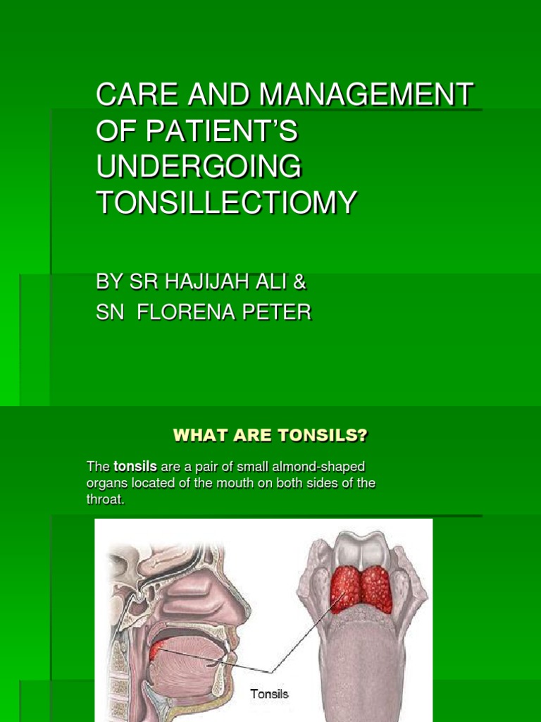 Tonsillitis case study nursing image