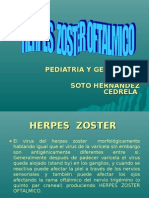 Herpes Zoster Oftalmico