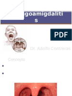 Faringoamigdalitis
