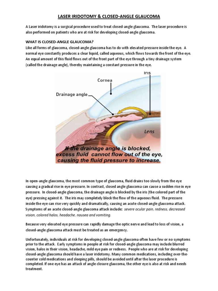 Laser Iridotomy and Human Eye