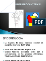 Fracturas Intertrocantericas