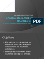 Bandas de Mach en Radiología