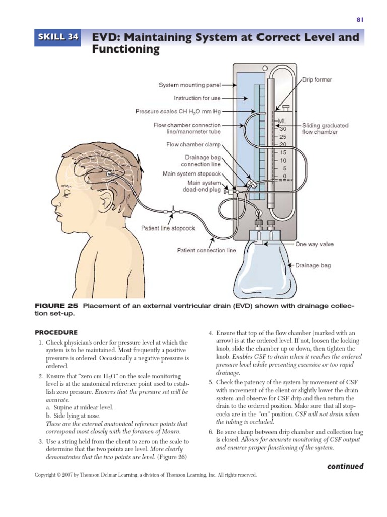 Skill 34[1]..EVD Maintaining System at Correct Level and Functioning