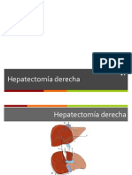 Resecciones Hepáticas 2