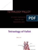 Tetralogy Fallot