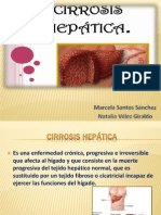 Cirrosis Hepatica