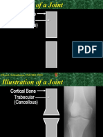 Illustration of Arthritis a Joint