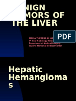 Benign Tumors of The Liver