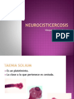 Neurocisticercosis presentacion