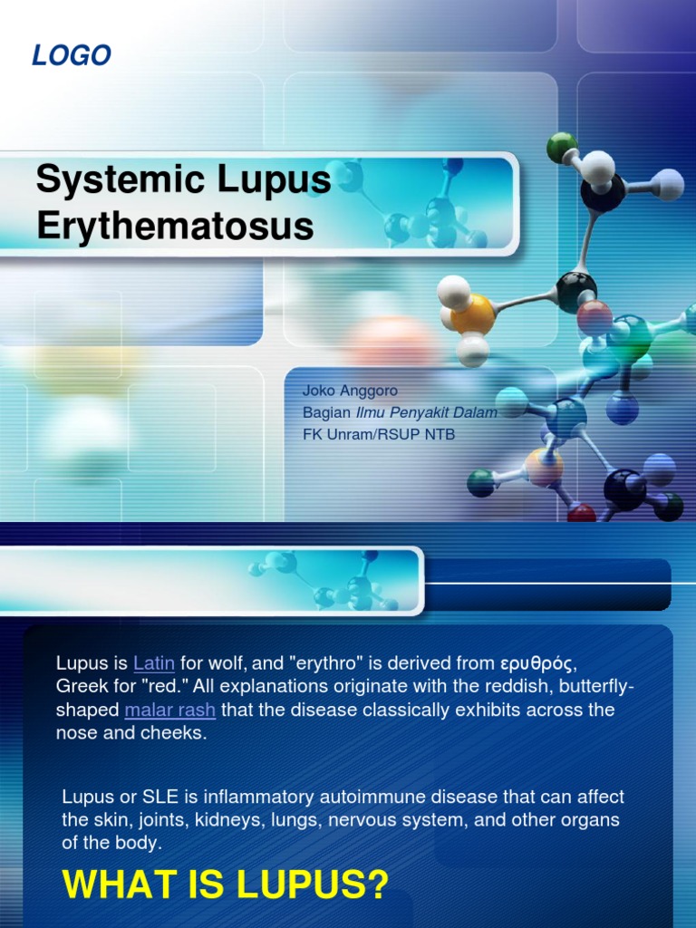 Systemic Lupus Erythematosus | PDF | Systemic Lupus Erythematosus ...
