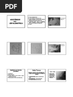 Análise Cefalométrica de USP