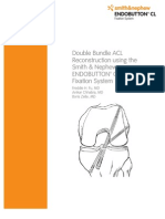 Double Bundle ACL Reconstruction Using Endobutton CL