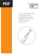 Endobutton Family Brochure | PDF | Surgical Suture | Medical Specialties