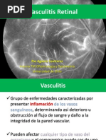 Vasculitis