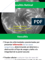 Vasculitis